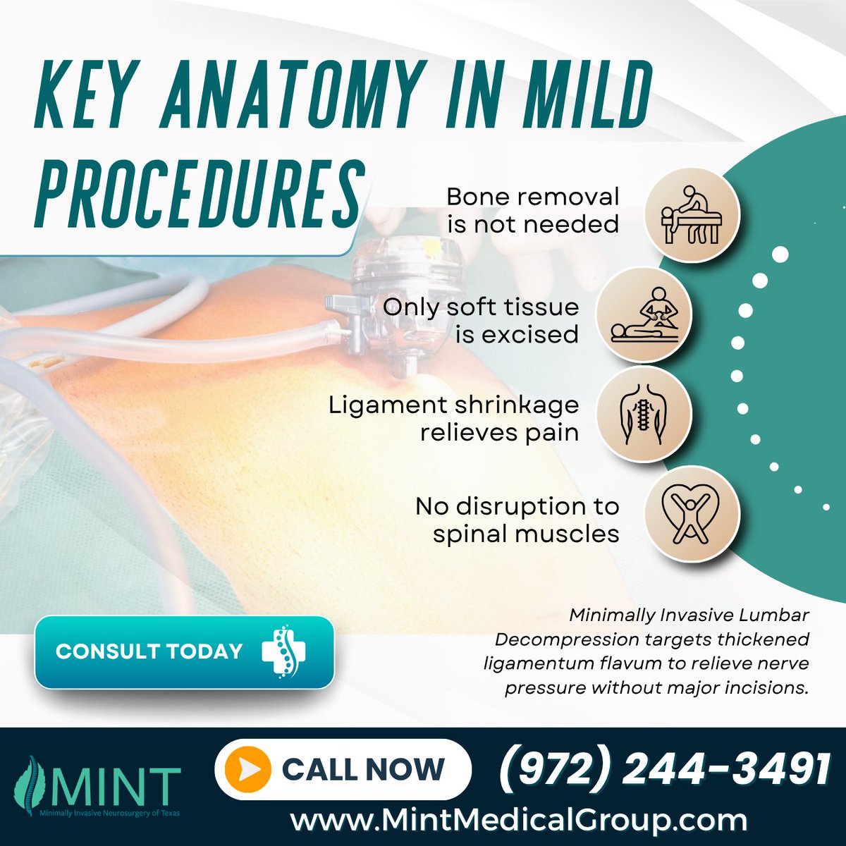 KutzMd's tweet image. Want real relief minus the long recovery? The back surgery pain relief spine doctor Lewisville TX offers modern MILD techniques with less downtime. Call (972) 244-3491. #SpineRelief #MinimallyInvasive #LewisvilleTX