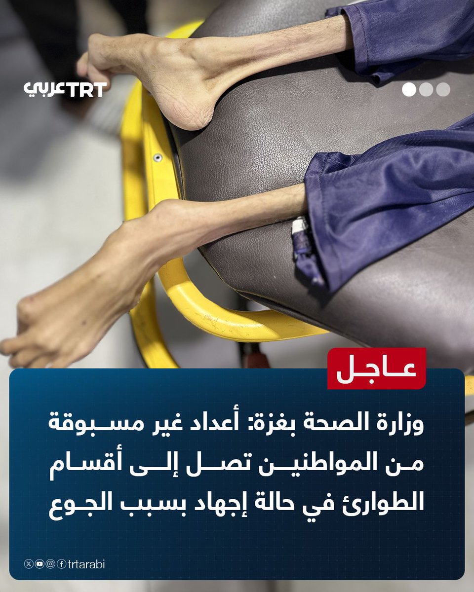 عاجل | وزارة الصحة بغزة: أعداد غير مسبوقة من المواطنين من كل الأعمار تصل إلى أقسام الطوارئ في حالة إجهاد بسبب الجوع