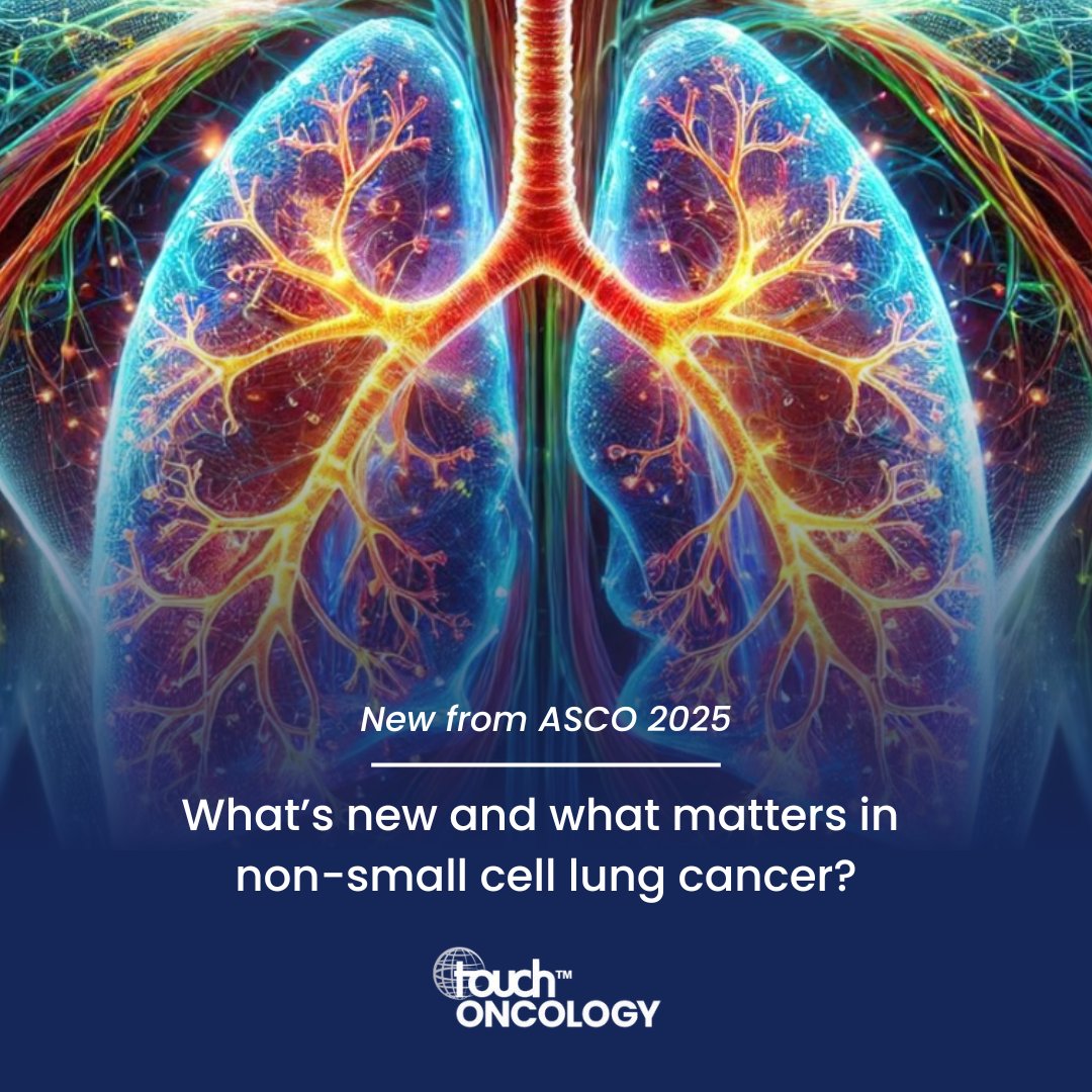 touchONCOLOGY's tweet image. 🗞️ #ASCO25 | What’s New in Early and Advanced NSCLC?

This year’s ASCO spotlighted several clinically meaningful advances.

touchONCOLOGY Editorial Board members Dr Fatemeh Ardeshir-Larijani and Dr Gabriel Lenz reflect on the key takeaways.

Read more: touchoncology.com/insight/asco25…