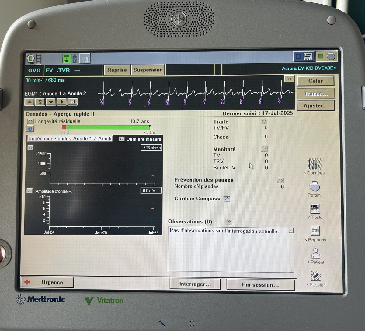 EPWaveDoc's tweet image. Successful implantation of EV-ICD #Medtronic Aurora in young patient with DCM with @RomainVergier and @PaulClaudien @ CHU #Martinique #Epeeps #Cardiology #cardiotwitter