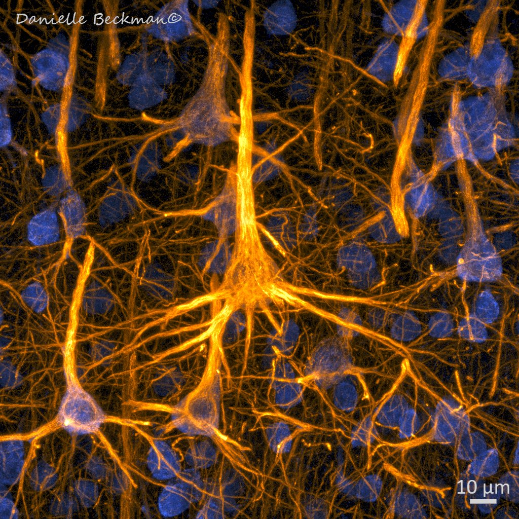 DaniBeckman's tweet image. Just pretty or useful? SMI32 🟡 targets a set of neurons more vulnerable to dementias. NeuN 🔵identifies most mature neurons in the cortex. Quantifying neurons identified by both markers can give you insights into neurodegenerative processes occurring in the 🧠#FluorescenceFriday