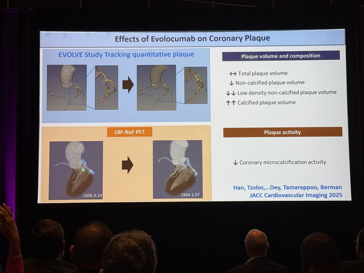 purviparwani's tweet image. Congratulations Dr. Damini Dey @CedarsSinai on receiving the 2025 Achenbach award! Thank you for your contribution to the world of #yesCCT #CVimaging #SCCT2025 

“Thank you Damini for making the plaque imaging cool before it was a thing”  
Dr. Kavitha Chinnaiyan