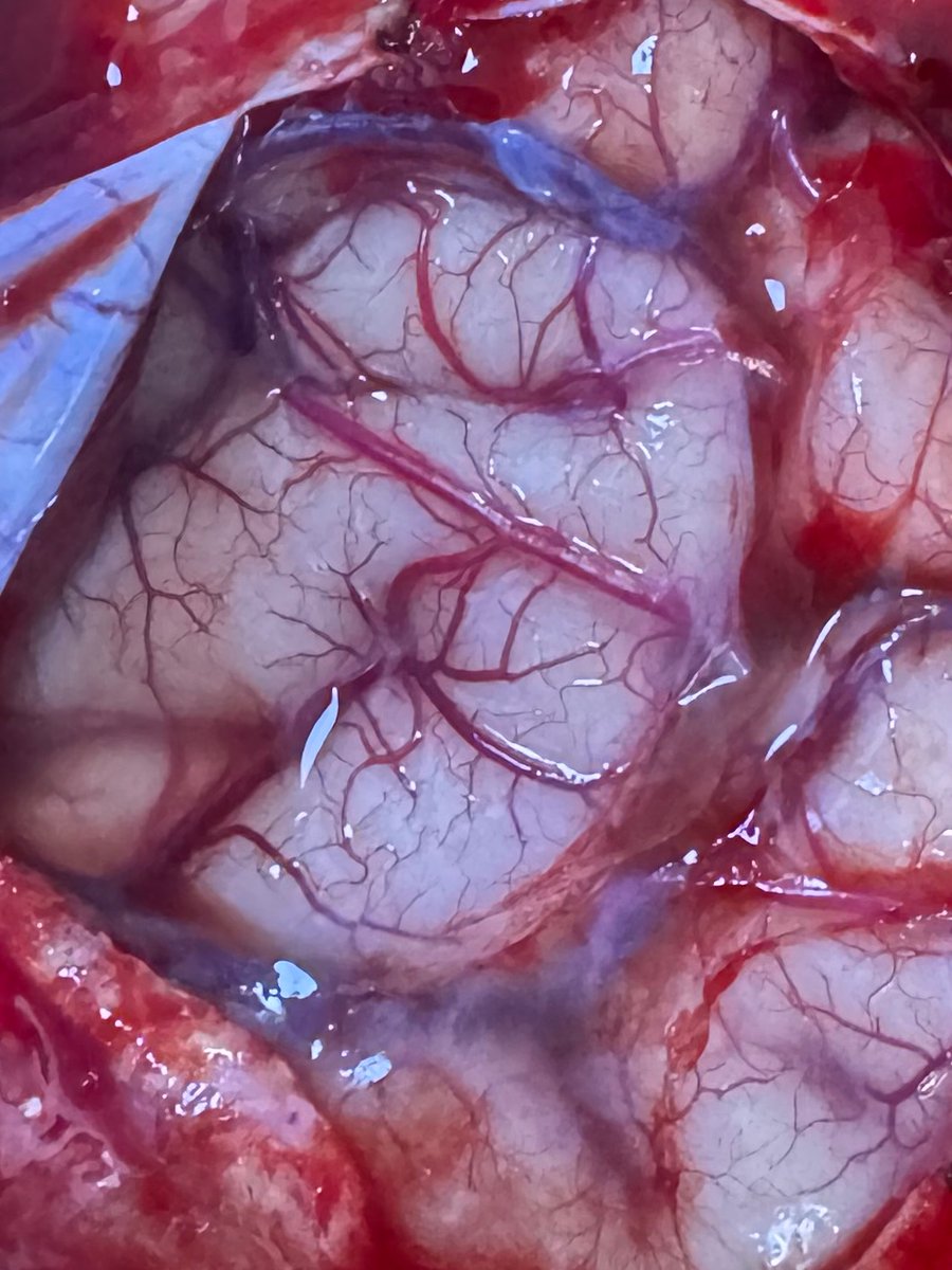 Brain 🧠 
10 X magnification