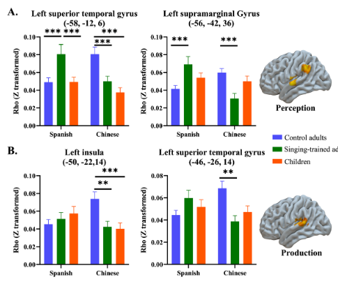ImagingNeurosci's tweet image. New paper in Imaging Neuroscience by Xiaohui Yan, Fan Cao et al.:
Neural correlates of foreign speech imitation: The effects of age and music
