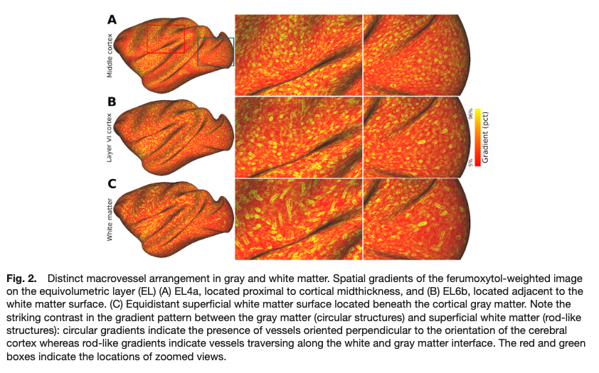 ImagingNeurosci's tweet image. New paper in Imaging Neuroscience by Ikko Kimura, Joonas A. Autio, et al:
Linking neuron-axon-synapse architecture to white matter vasculature using high-resolution multimodal MRI in primate brain