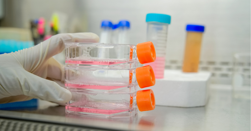 mndassoc's tweet image. It's #WorldBrainDay! 🧠
We have loads of great blogs that discuss research, understanding and MND links with the brain.
Check out this one about reconstructing the human brain - in the lab! 😲
👉mndresearch.blog/2024/03/14/rec…
#MND