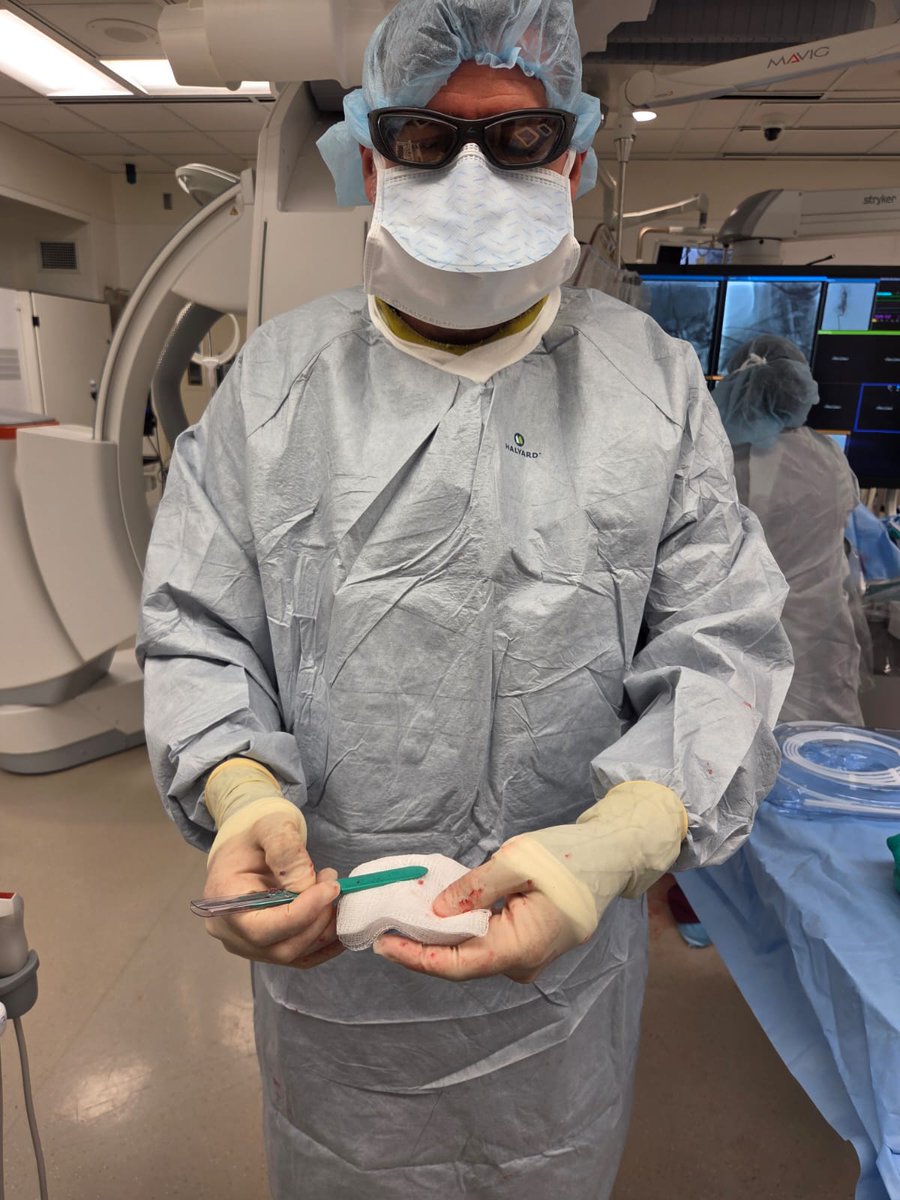CerebrovascLab's tweet image. 📍Second enrollment at @uiowa for the ATHENA trial! Proud to contribute to advancing acute stroke care through this important multicenter effort.
@anaconda_biomed
#StrokeResearch #UIowa #ClinicalTrials #NeuroIntervention @marcriboj @ZanatyMario
@UIowaResearch @IowaNeurology…