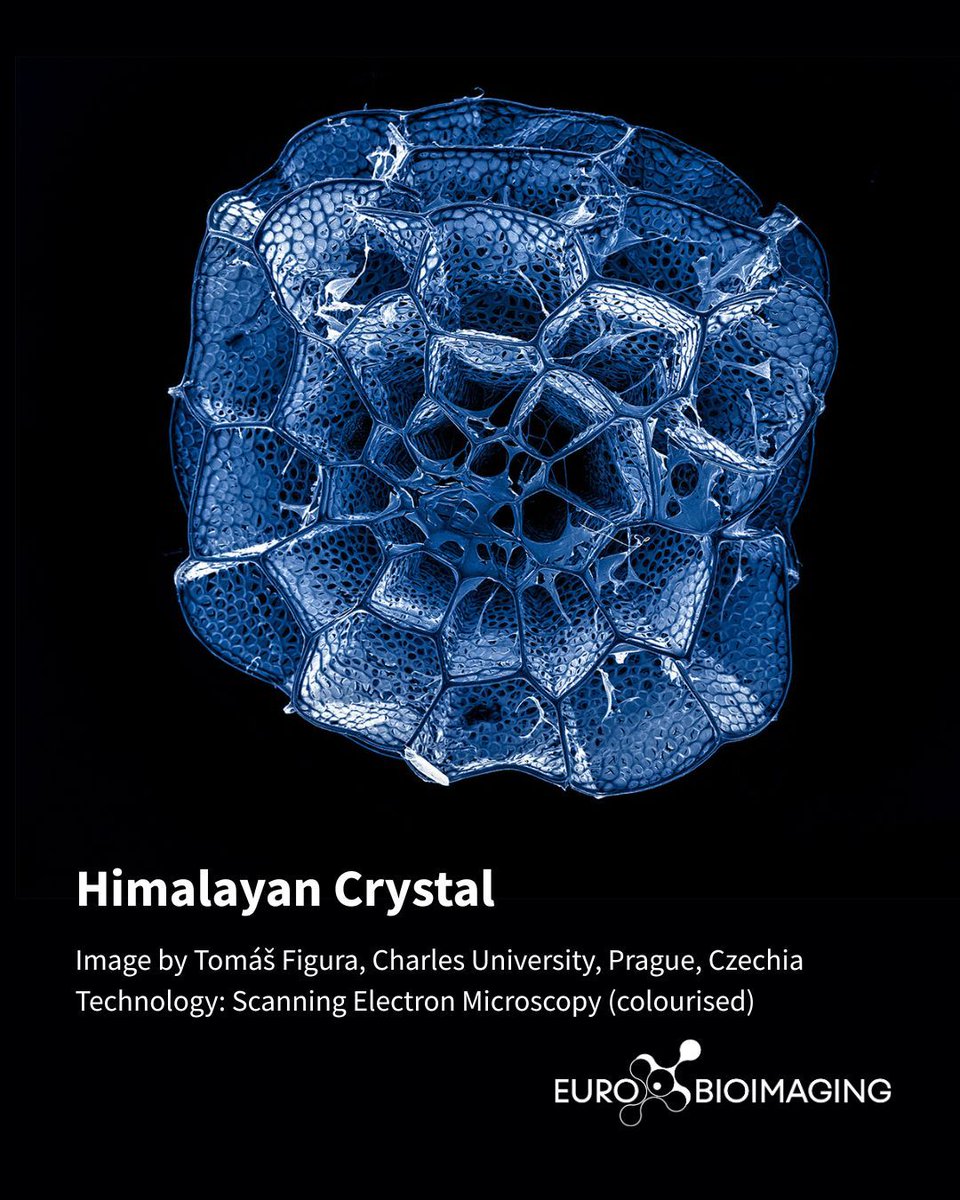 EuroBioImaging's tweet image. 🥁 Excited to announce the winner of the "Spring" Imaging contest! 🔬
🥇 1st prize: Tomáš Figura, Charles University, with 2 images, “Himalayan Crystal” (see below) & “Four Shades of Pollen Allergy.”
More🔽
eurobioimaging.eu/news/congratul…