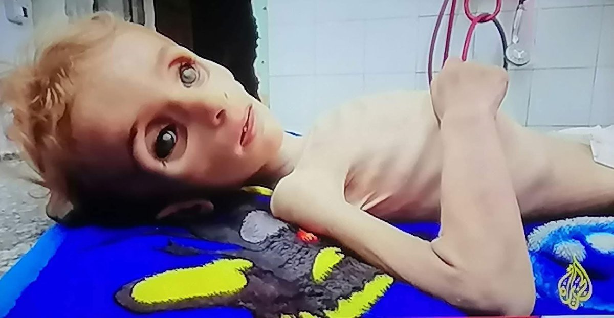 الرضيعة "سناء اللحام" ماتت جوعًا في غزة، وحسبنا الله ونعم الوكيل.

#غزة_تموت_من_الجوع