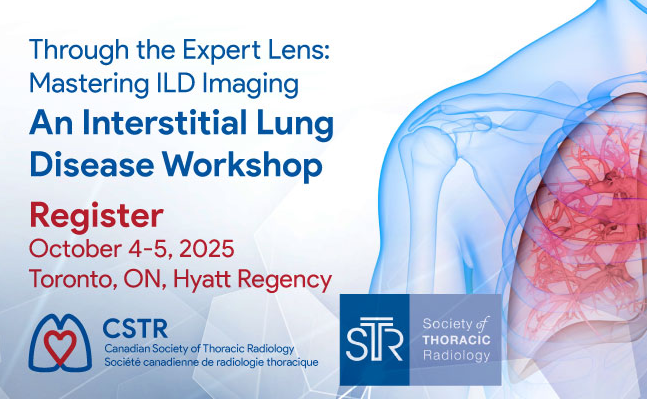 thoracicrad's tweet image. Want to sharpen your ILD skills with world-renowned thoracic radiologists? Join the CSTR and STR in Toronto on October 4-5, 2025, for "Through the Expert Lens: Mastering ILD Imaging" tinyurl.com/3wbbpp4u
