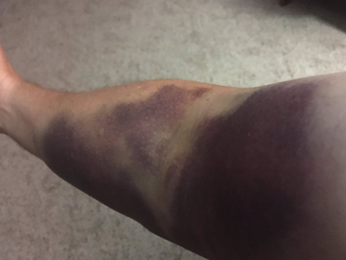 Joe Smith tweet media