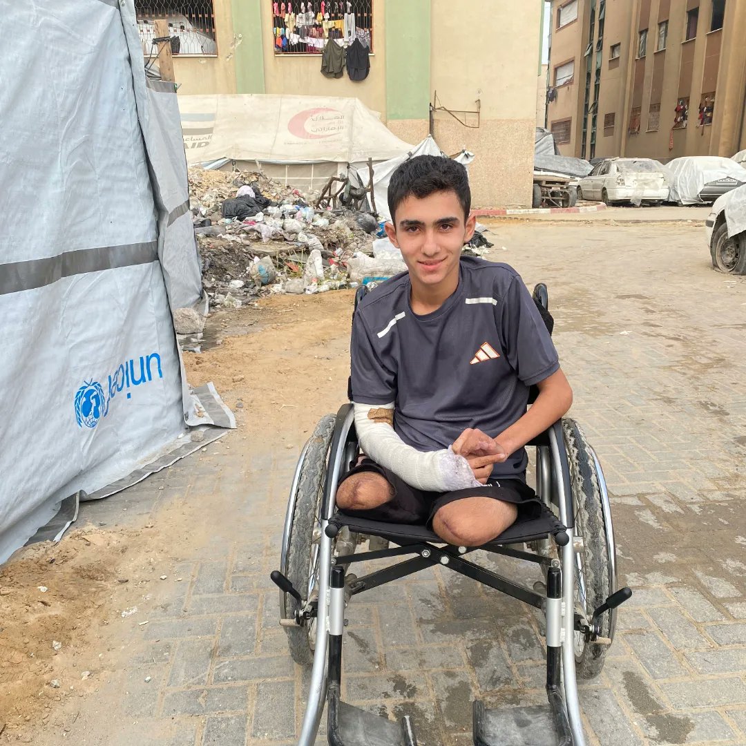_ahmed_gaza_'s tweet image. The Wound Is Deep, But Hope Still Lives β Your Support Can Be Life-Changing"
π A young soul is in urgent need of medical treatment. Even the smallest donation can bring light to this darkness.
π Please consider donating β every dollar counts, every share helps.
