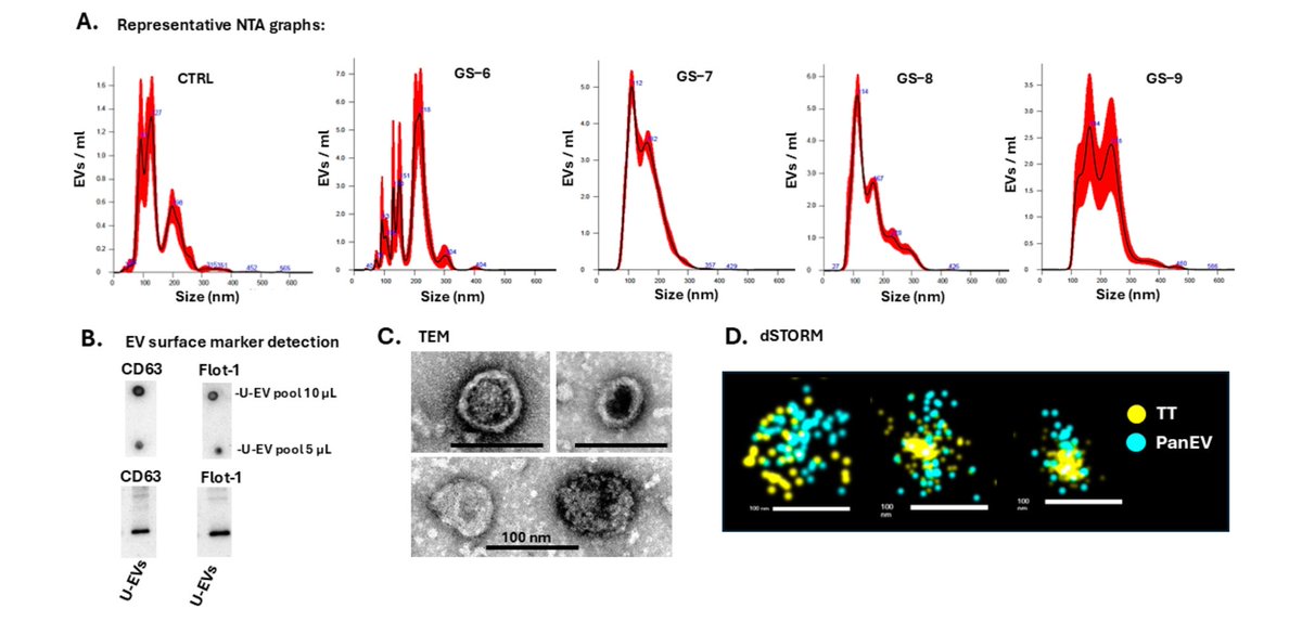 nikhilvasdevuro's tweet image. Can we avoid prostate biopsies ? And consider using Urinary Extravesicle Signatures in patients with suspected prostate cancer.
Breakthrough data published today from our lab @UniofHerts @enherts in collaboration with @LondonMetUni @UniWestminster @OpenUniversity @HarwellCampus…