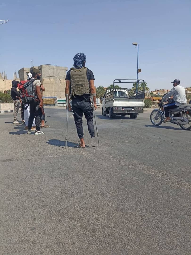 أيُّ إيمانٍ هذا، وأيُّ رجولةٍ تُقاس برجالٍ لم تهزمهم الجراح، ولم تُقعدهم الإصابة!
بأطراف مبتورة وقلوبٍ مشتعلة، لبّوا النفير، وحملوا السلاح، وتقدّموا الصفوف بشموخ، دفاعًا عن الأرض والعِرض.
لم تكن إصابتهم عجزًا، بل كانت وسام بطولة.
هنيئًا لسوريا برجالٍ كهؤلاء... هذا هو الشعب السوري