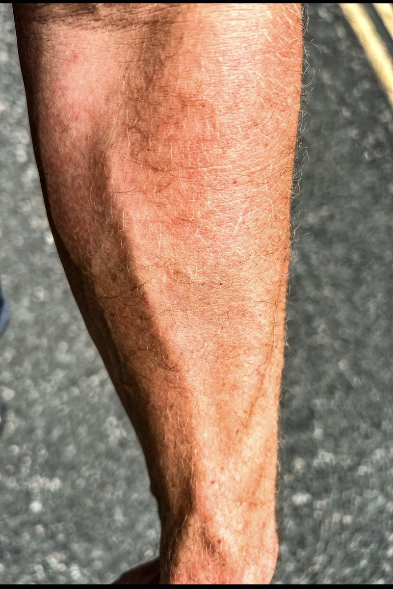 thecoachcw's tweet image. Not as big as the dudes on here but still.
Vascularity is cool af