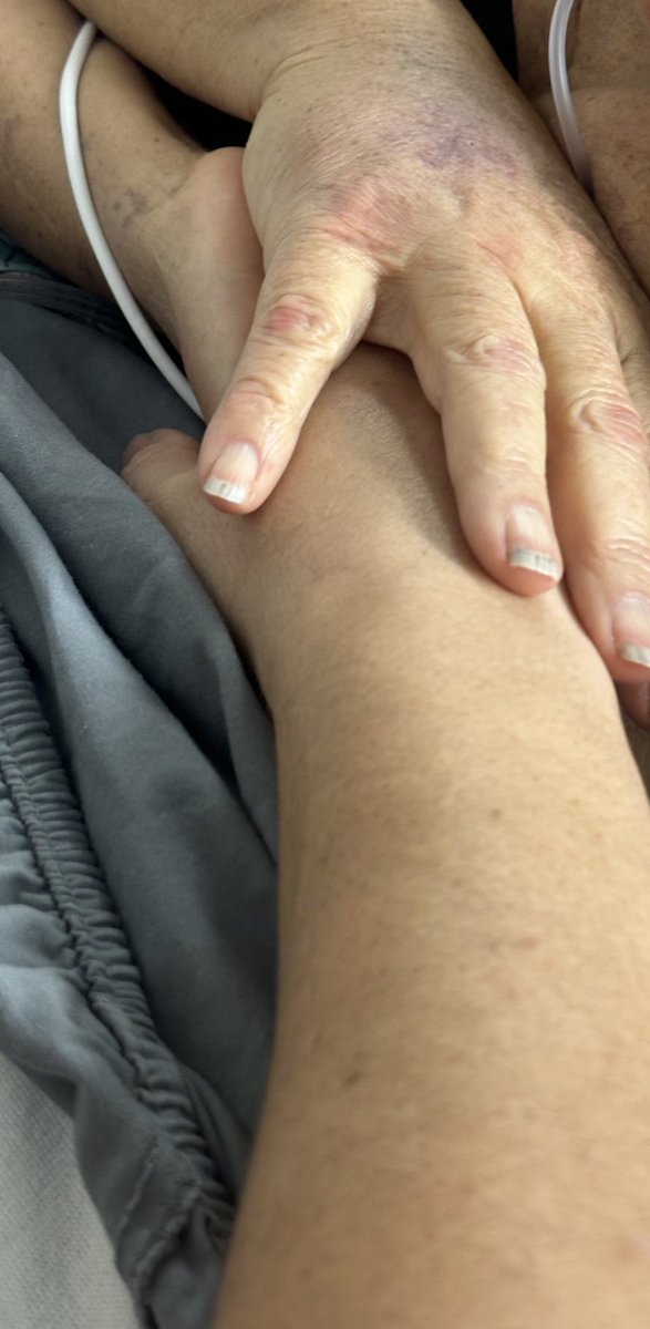 MarieePhilomena's tweet image. My dear friends, thank you for always being there for me. My mom is on her last days/hours. Please continue to storm heaven, especially so she can pass peacefully and that she won’t be attacked spiritually in her last hours. Please pray for me and my family during this time. We…