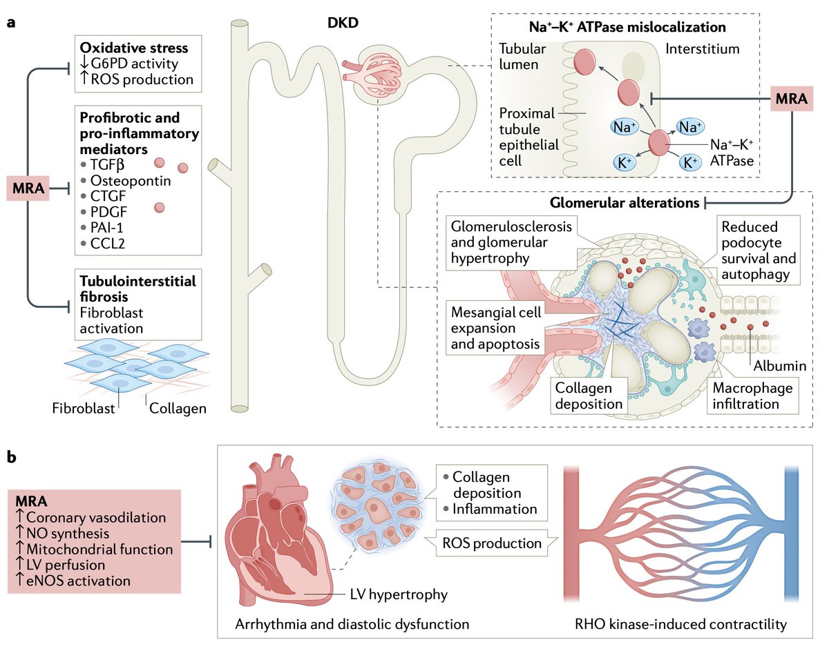 Muy buena imagen de los efectos del antagonismo de los receptores mineralocorticoides en glomérulo y corazón 
🙌🏻🙌🏻 Finerenona