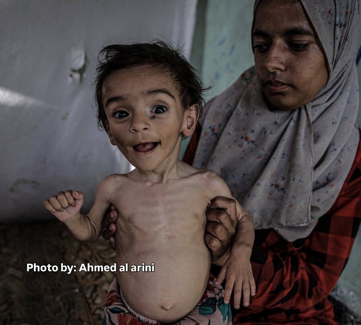 اللهمَّ اخذل من خذلهم وانصر من نصرهم
#GazaStarving 
 #غزه_تموت_جوعاً
