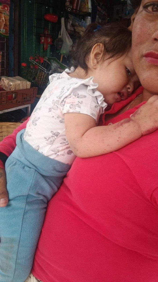 RaulGtzNR's tweet photo. La señora murió atropellada su hija sobrevivío en Lechería, urge localizar a sus familiares de la menor. https://t.co/cro8UsQa73