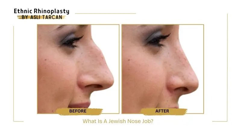 Anti_NWO_Front's tweet image. Just a reminder Jews are known to engage in mimicry in an attempt to obfuscate their Jewishness. The beak isn’t the only tell