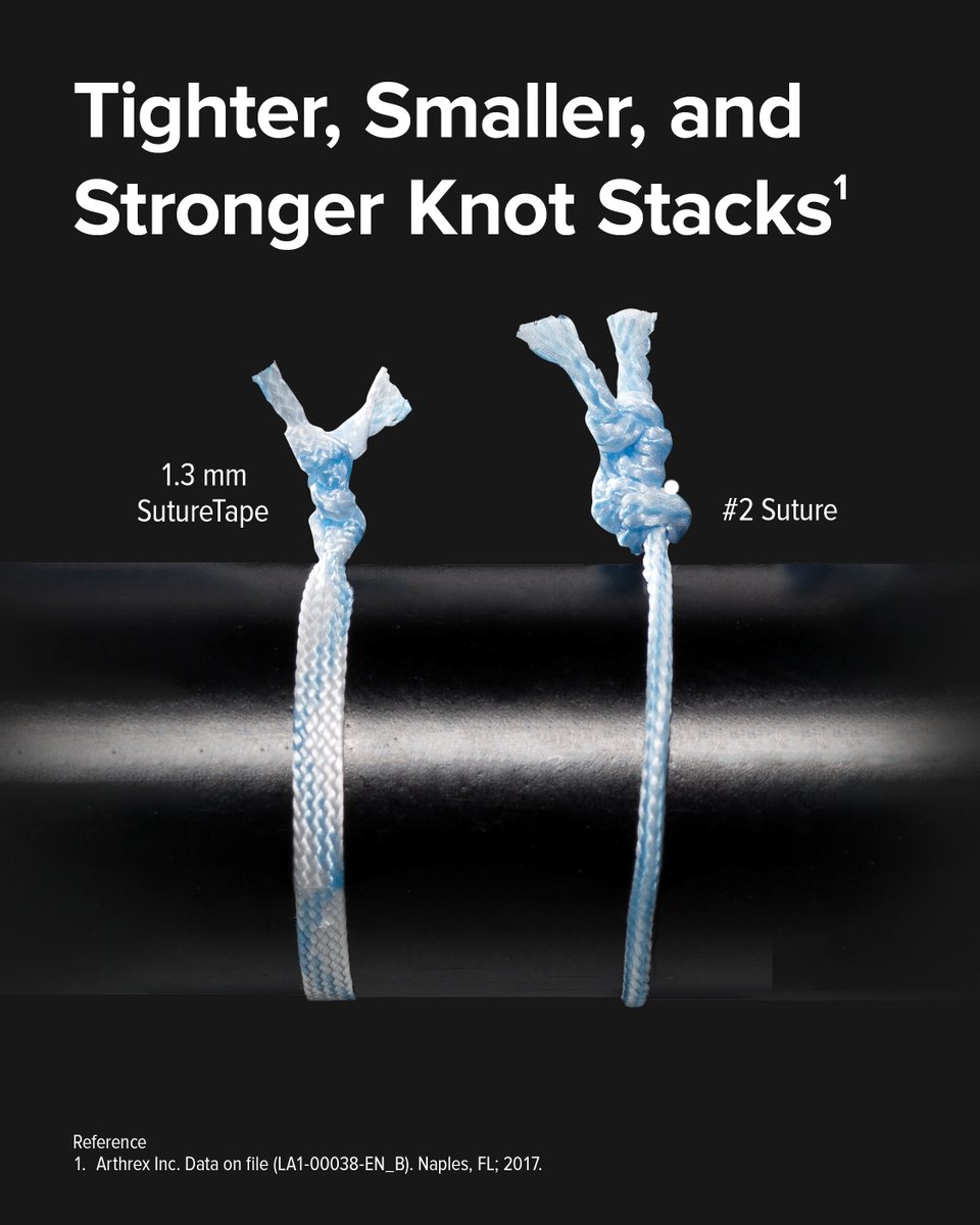 ArthrexMedEd's tweet image. Offering improved handling and knot security with smaller comparable knot stacks,* FiberWire® SutureTape feels flat out better than round suture.
Learn more about the next generation in suture technology: arthrex.info/4nPC2GN
*Arthrex Inc. Data on file (LA1-00038-EN_B).…