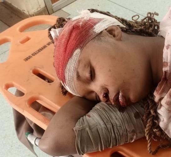 _James041's tweet photo. Hi everyone this lady was involved in a Road Traffic Accident today along Outering Road at around 11am.
According to bystanders her names are Winnie Grace Wanjiru.
If anyone knows her kindly reach out on 0723500478 or 0742400102 so that we can connect her to her next of keen.
Kindly share widely