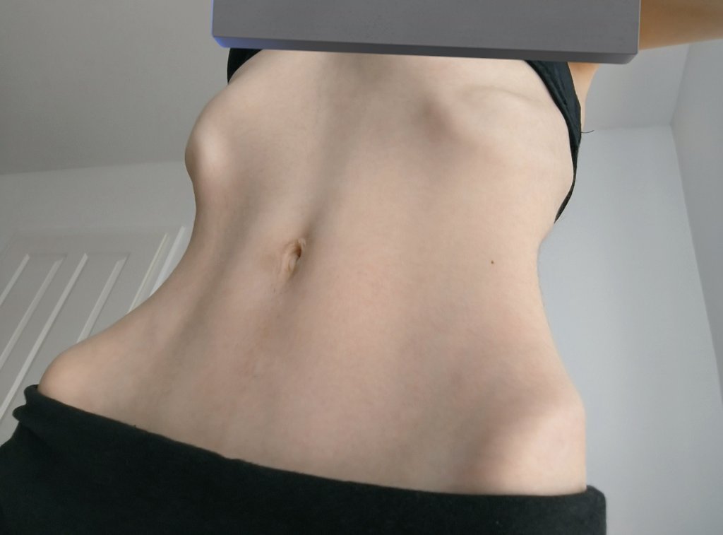 bulimiarch's tweet image. body checks from this morning