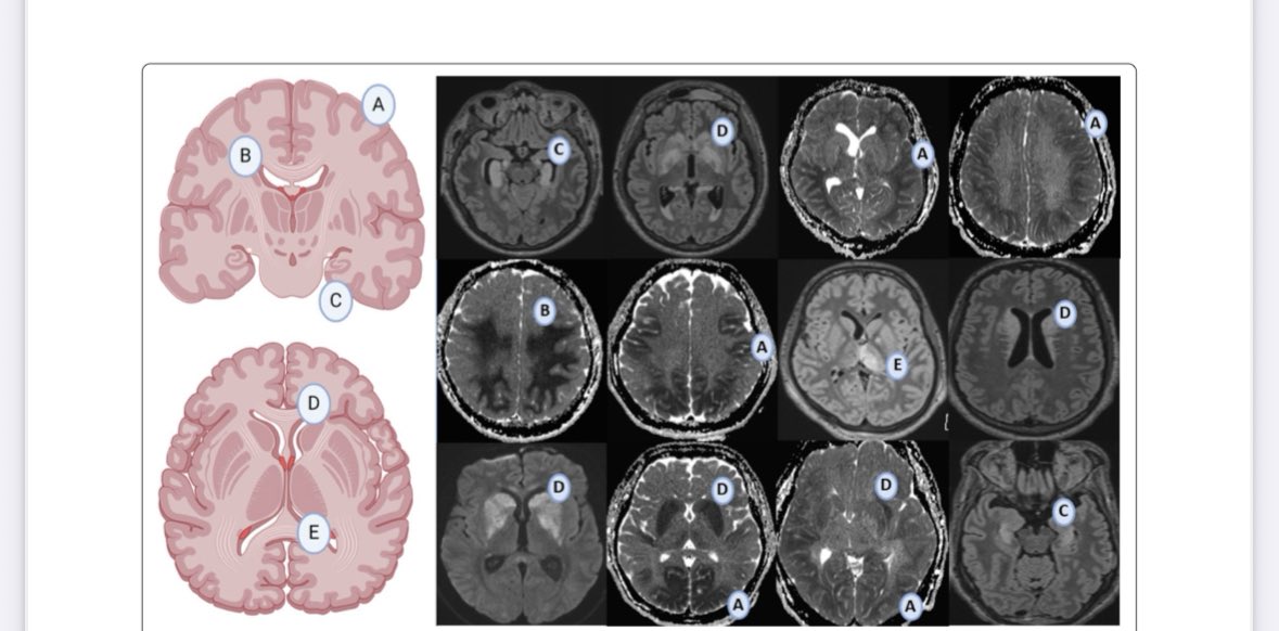chiara_robba's tweet image. Individualized care in cardiac arrest!