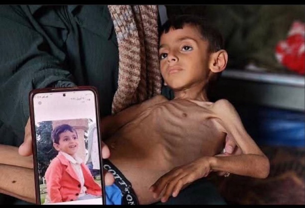 MuseSomaly's tweet photo. #GazaGenocide‌ Children. https://t.co/Swlv7LEi8N
