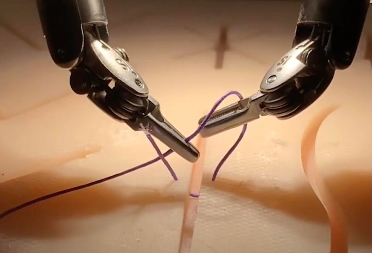 JHTechVentures's tweet image. The Smart Tissue Autonomous Robot (STAR), developed at @JohnsHopkins, performed the first autonomous soft-tissue laparoscopic surgery without any human guidance.
It outperformed human surgeons in precision & consistency.
Learn more: buff.ly/h76XGqR