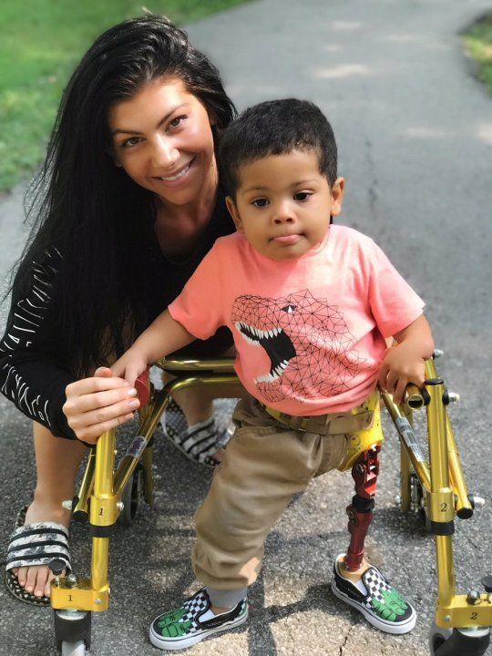 Kristinartz's tweet image. He may have a prosthetic leg, but his spirit walks tall. With her by his side, nothing is impossible. Say Hi or Follow for this little hero. 💪❤️🙏