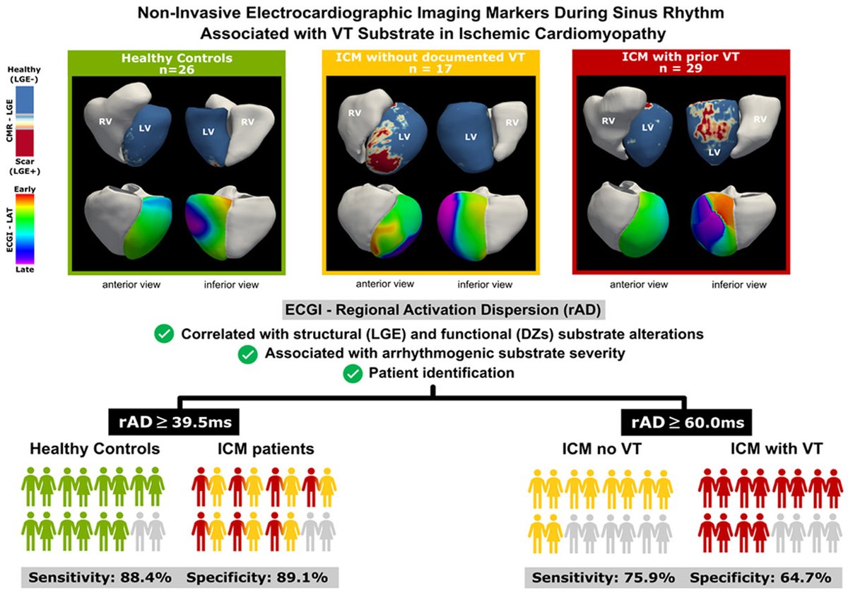 HeartRhythm (@hrs_journal) on Twitter photo Non-Invasive Assessment of the Ventricular ArrhythmogenGraphical abstract undfig1ic Substrate Using Electrocardiographic Imaging During Sinus Rhythm: the NIAVAS study
<a href="/janareventos/">Jana Reventós Presmanes</a> <a href="/ivroca/">Ivo Roca, FEHRA, FESC</a>
heartrhythmjournal.com/article/S1547-… Non-Invasive Assessment of the Ventricular ArrhythmogenGraphical abstract undfig1ic Substrate Using Electrocardiographic Imaging During Sinus Rhythm: the NIAVAS study
<a href="/janareventos/">Jana Reventós Presmanes</a> <a href="/ivroca/">Ivo Roca, FEHRA, FESC</a>
heartrhythmjournal.com/article/S1547-…