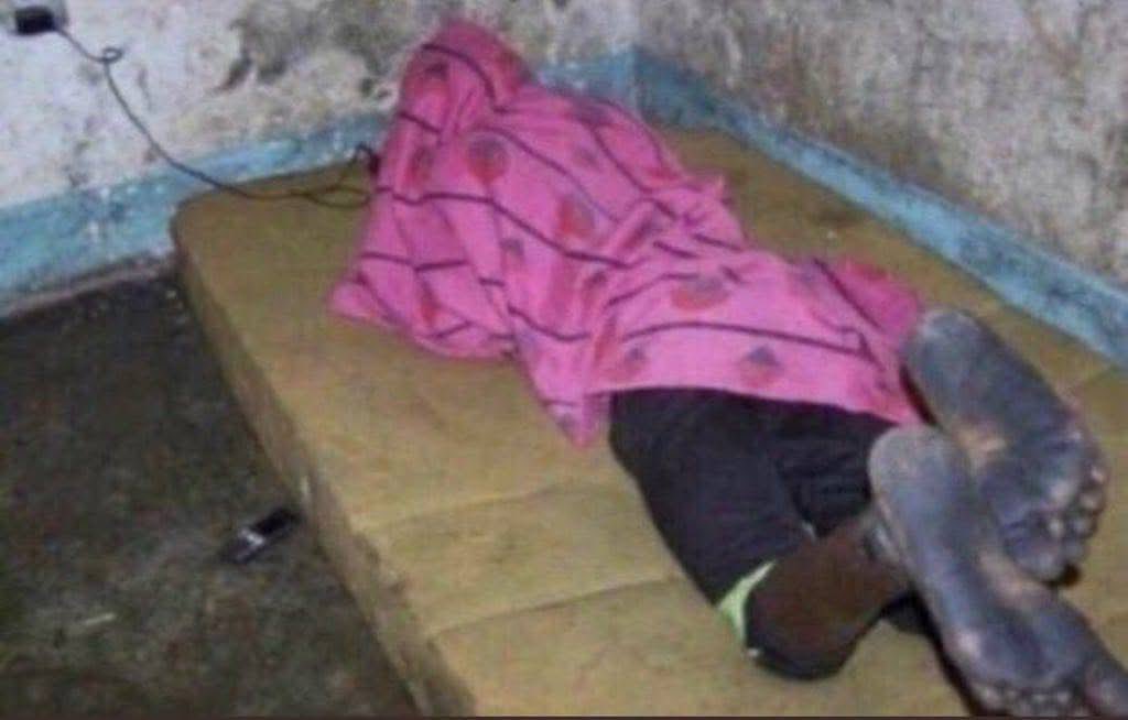 nikuje tuhesabu stretch marks 😲😅😅