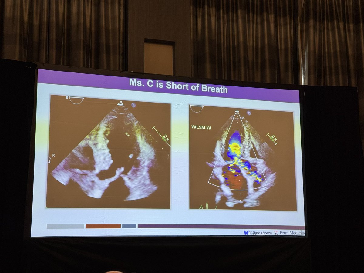 Ryan J Tedford MD (@ryantedfordmd) on Twitter photo Dr. Nosheen Reza just gave a TED-style masterclass on HCM—aka the OG HFpEF—at #CharlestonHFpEF. Crystal clear, high impact, and delivered like a boss. 👏🫀 #HCMQueen <a href="/noshreza/">Nosheen Reza, MD, MS</a> <a href="/heartsuccessMD/">Jessica Atkins</a> Dr. Nosheen Reza just gave a TED-style masterclass on HCM—aka the OG HFpEF—at #CharlestonHFpEF. Crystal clear, high impact, and delivered like a boss. 👏🫀 #HCMQueen <a href="/noshreza/">Nosheen Reza, MD, MS</a> <a href="/heartsuccessMD/">Jessica Atkins</a>
