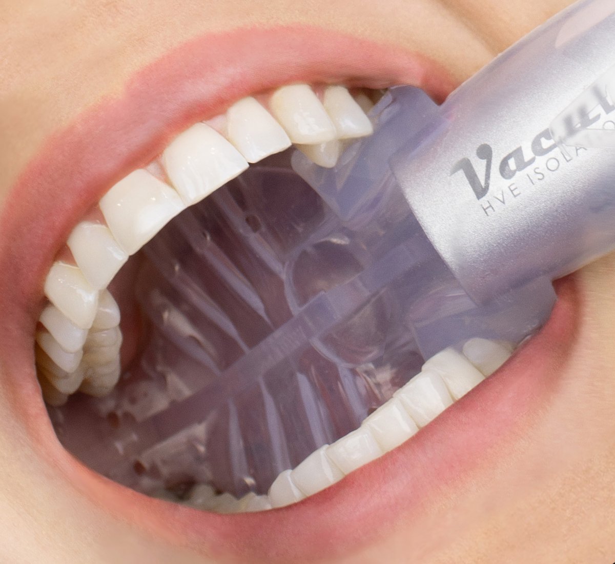 Consistent evacuation. Unrivaled isolation. Total patient comfort. You already know the clinical benefits of the VacuLUX mouthpiece. But what if your workflow could be even better? 

#vaculux #somethingnewiscoming