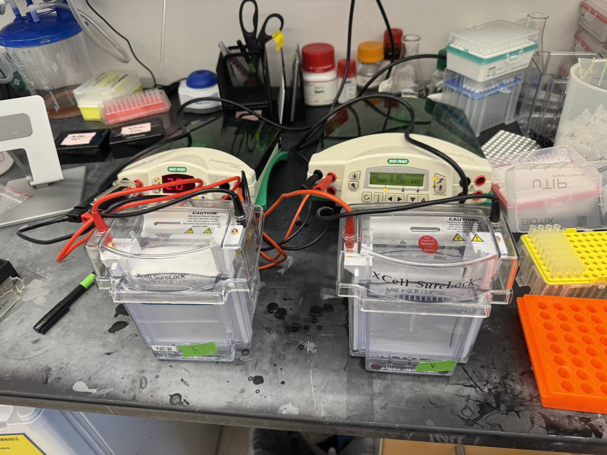 Tim (@timkong_) on Twitter photo New institution, same affinity for running gels #leuklabafterleukconsults #noflowforme <a href="/WeillCornell/">Weill Cornell Medicine</a> <a href="/MSKCancerCenter/">Memorial Sloan Kettering Cancer Center</a> New institution, same affinity for running gels #leuklabafterleukconsults #noflowforme <a href="/WeillCornell/">Weill Cornell Medicine</a> <a href="/MSKCancerCenter/">Memorial Sloan Kettering Cancer Center</a>