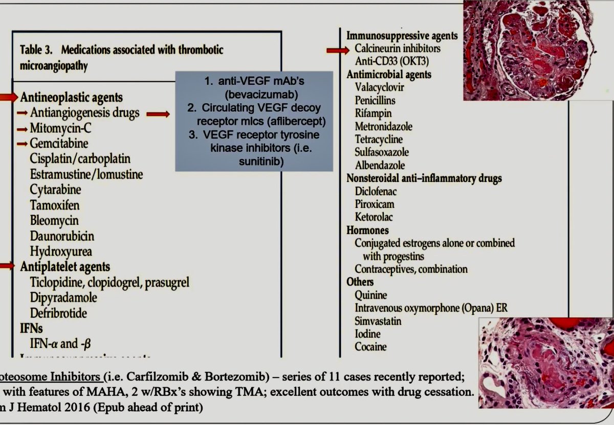 Drug induced GN &amp; TMAs