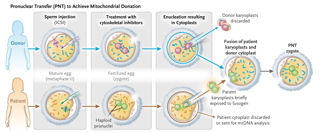 Brief Report: Mitochondrial Donation in a Reproductive Care Pathway for mtDNA Disease nej.md/466FQgw 

Original Article: Mitochondrial Donation and Preimplantation Genetic Testing for mtDNA Disease nej.md/455eer6 

Science behind the Study: Advances in