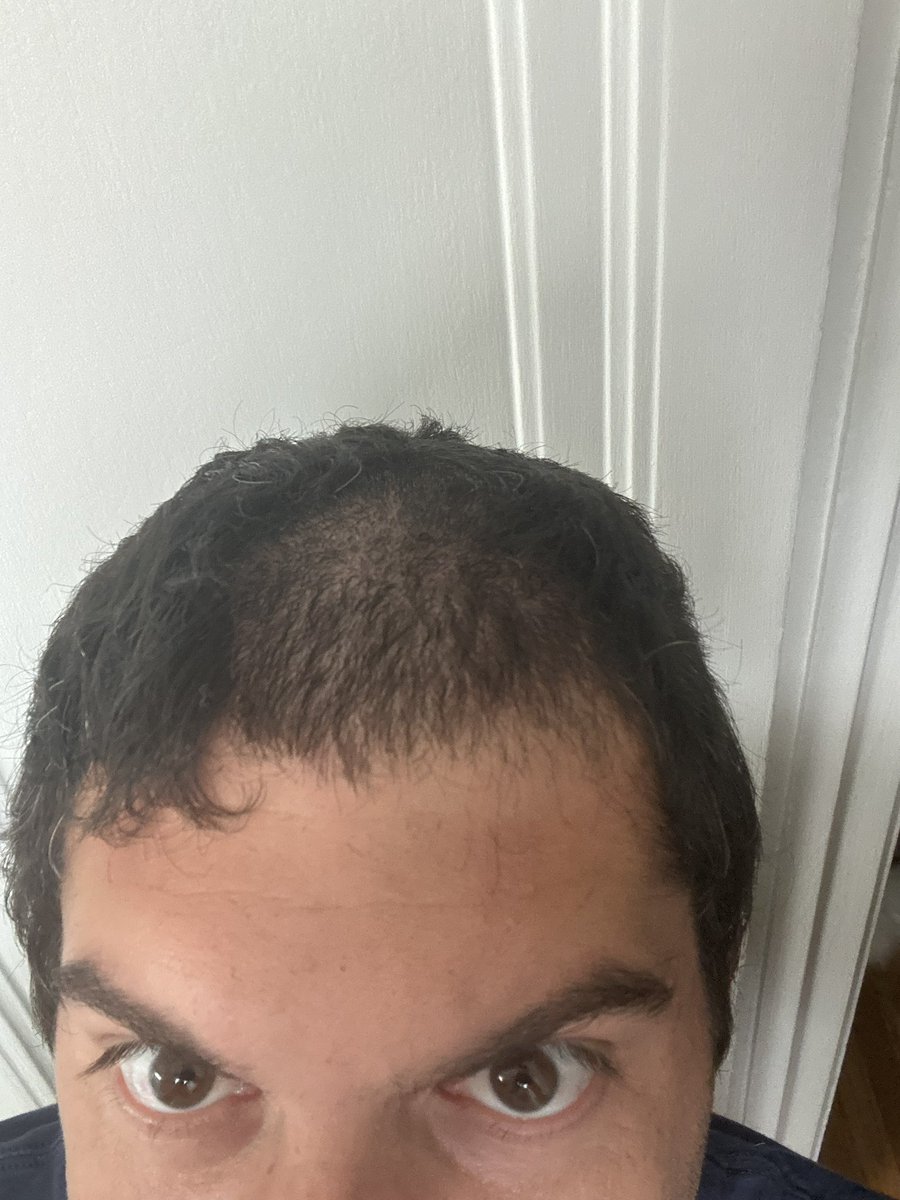 SandroWestXXX's tweet photo. @realtatehoskins I started shaving my head without charging my pube trimmer and here we are for the next hour haha https://t.co/aGOlPcxbuU
