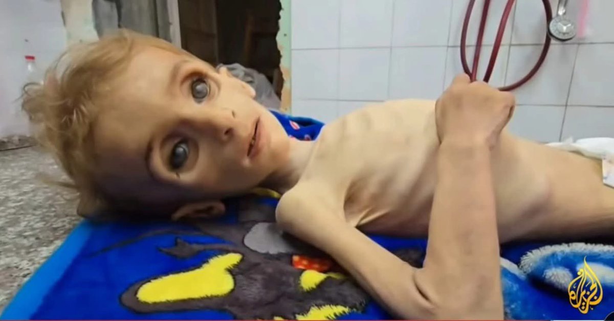 #غزه_تموت_جوعاً 
#GazaGenocide 
#gazastarves