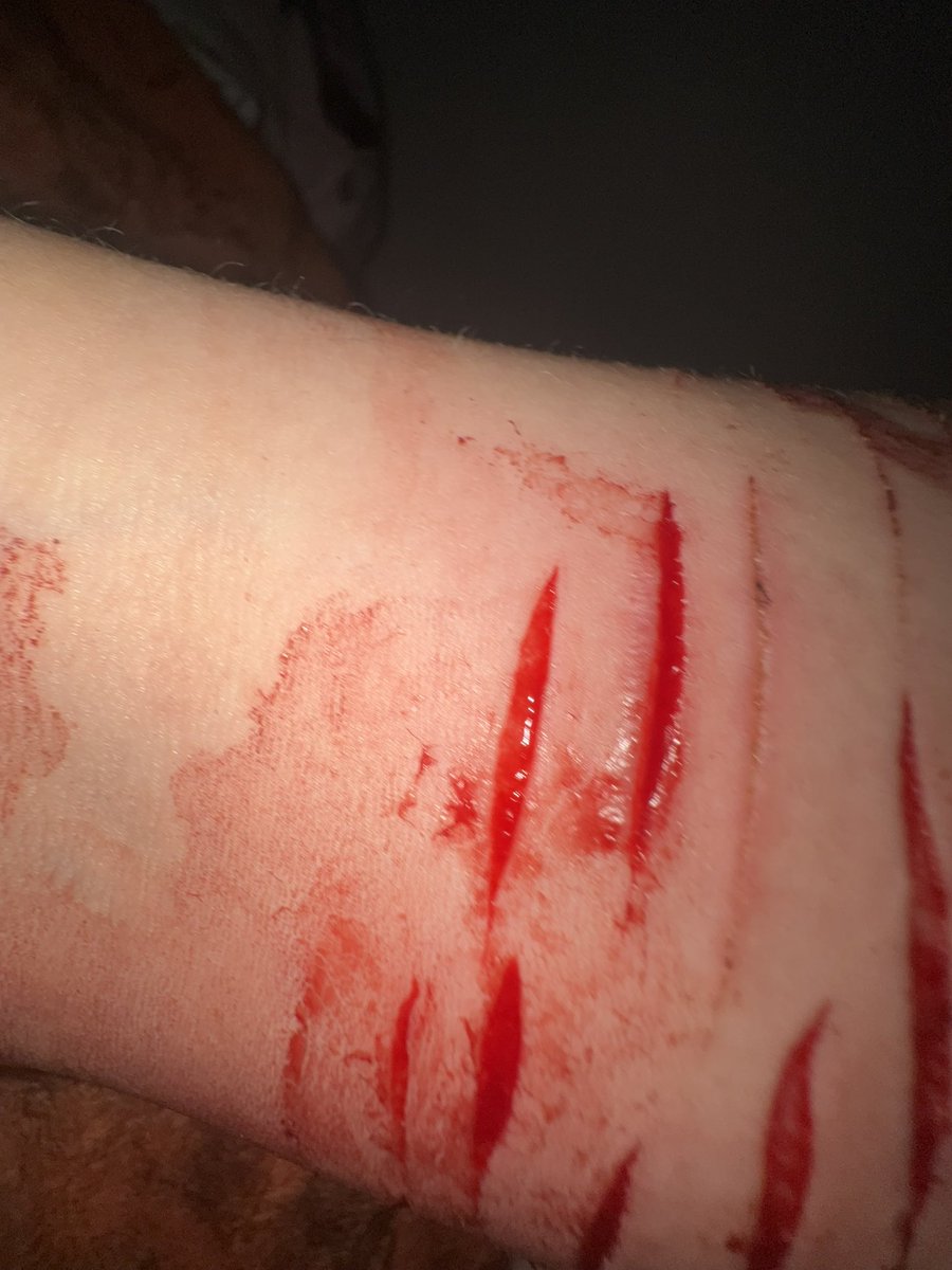 #shtwt #selfharm #SELFHARMTRIGGERWARNING