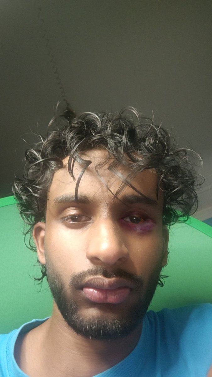 marc0fier0's tweet image. I decided to try something different from CalyZama and got BEAT UP