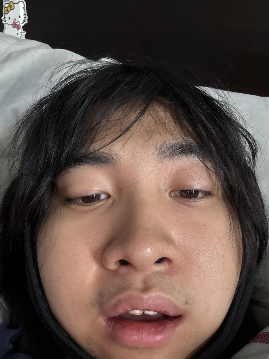 LiterallyMeGuy's tweet image. Agony