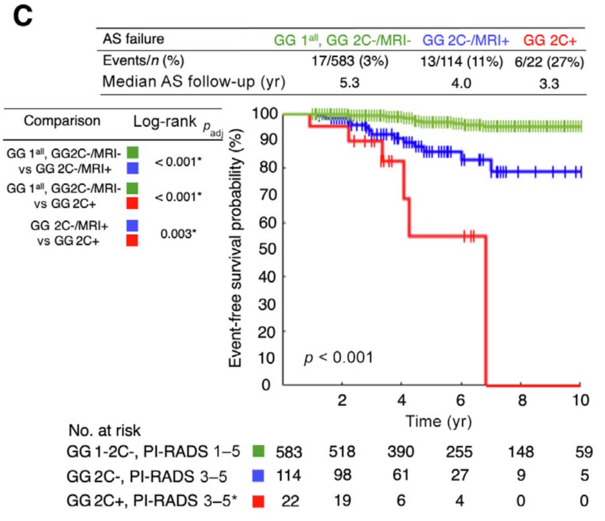 7/

📝Summary

✅ AS *very safe* for all GG1 

✅ AS *very safe* for MRI-invisible GG2 non-cribriform

❌❌ Cribriform → do not offer AS

☑️ MRI-visible, non-cribriform GG2 → AS safe but 🤔could benefit from ⬆AS intensity?