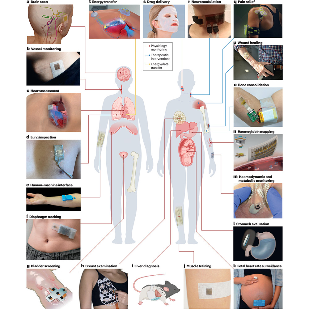 NaturePortfolio's tweet image. A Review in @natrevbioeng discusses wearable ultrasound technology, highlights key barriers to wide deployment and explores future development directions. go.nature.com/4eYjz70 🔒