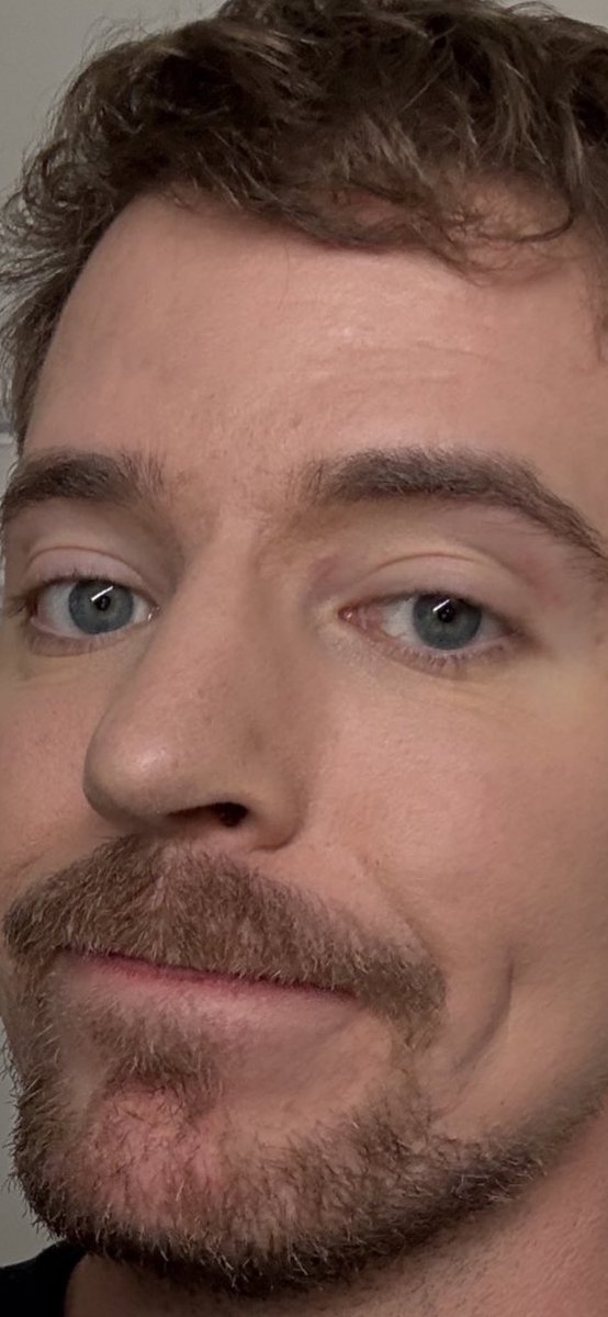 regularpikachu's tweet image. Why does Mr beast look like he’s on percs