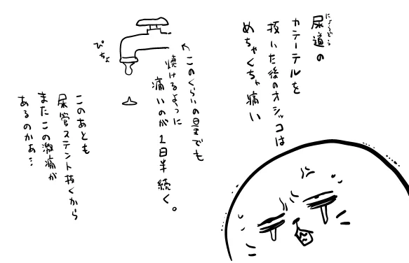 やっと普通におしっこできるようになりました(ステントで腰痛起きるけど) 