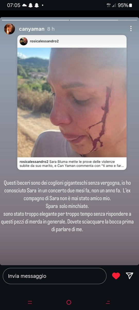 Lo sapevamo che sarebbe sbottato....!
Quando si tratta di Can ne dicono di tutti i colori e inventano tutto pur di dare notizie non vere...ex compagno di Sara già si era classificato scrivendo quel commento!
È proprio vero sciacquatevi la bocca prima di parlare di Can!
#CanYaman