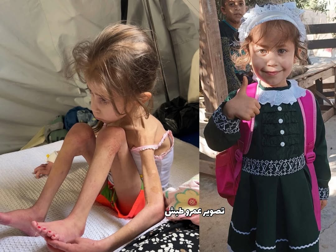 Gazzeli çocuklar açlıktan ölüyor 💔