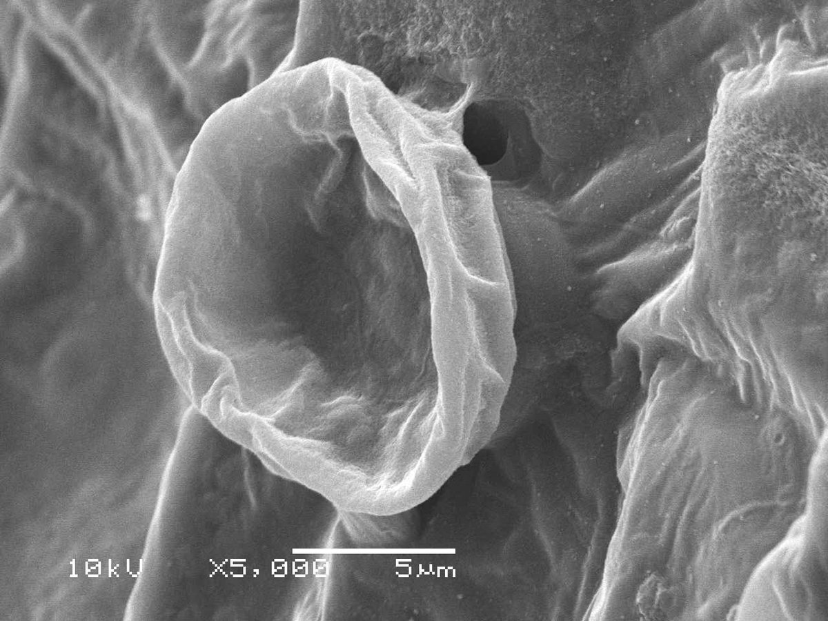 無事、新たな手法で作った試料は破裂することなくタヌキモの捕虫嚢をパンパンに膨らませた状態で撮影できました。
排水する穴も綺麗に見えました。

いや～よかった、よかった。謎も解けました。

そして、いつも丁寧に対応してくださるMさん、今回は特にありがとうございました！！助かりました。